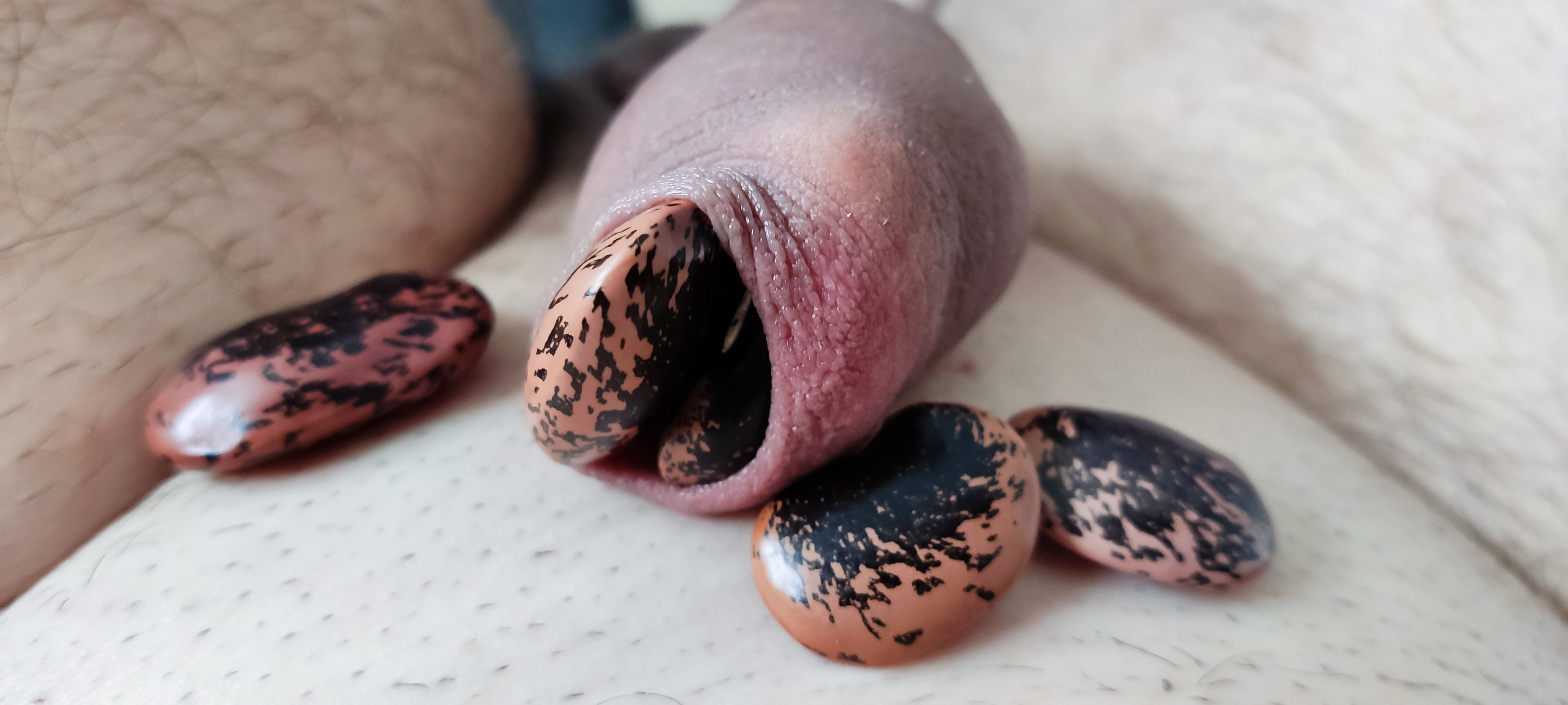 My foreskin play - bean