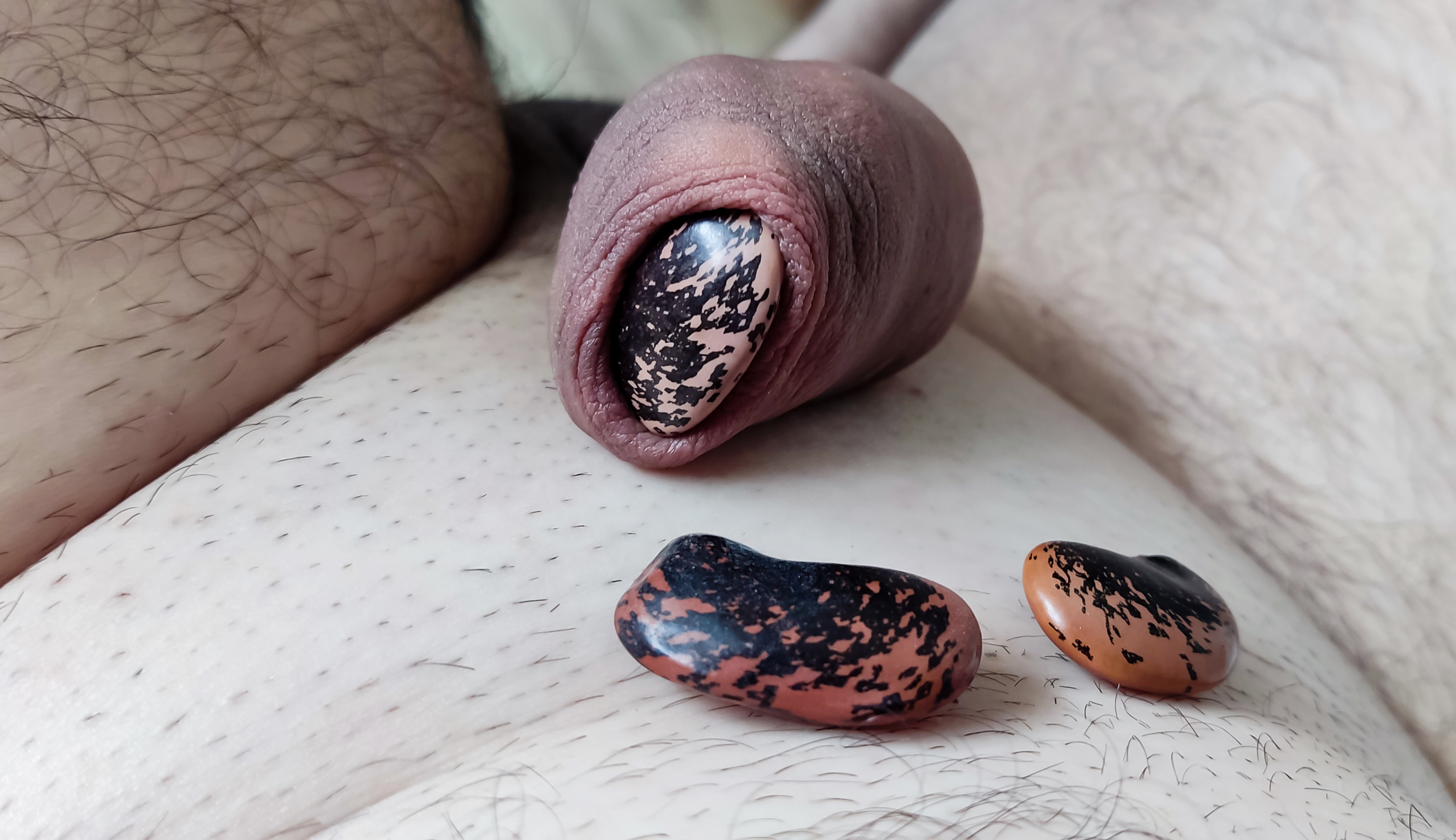 My foreskin play - bean