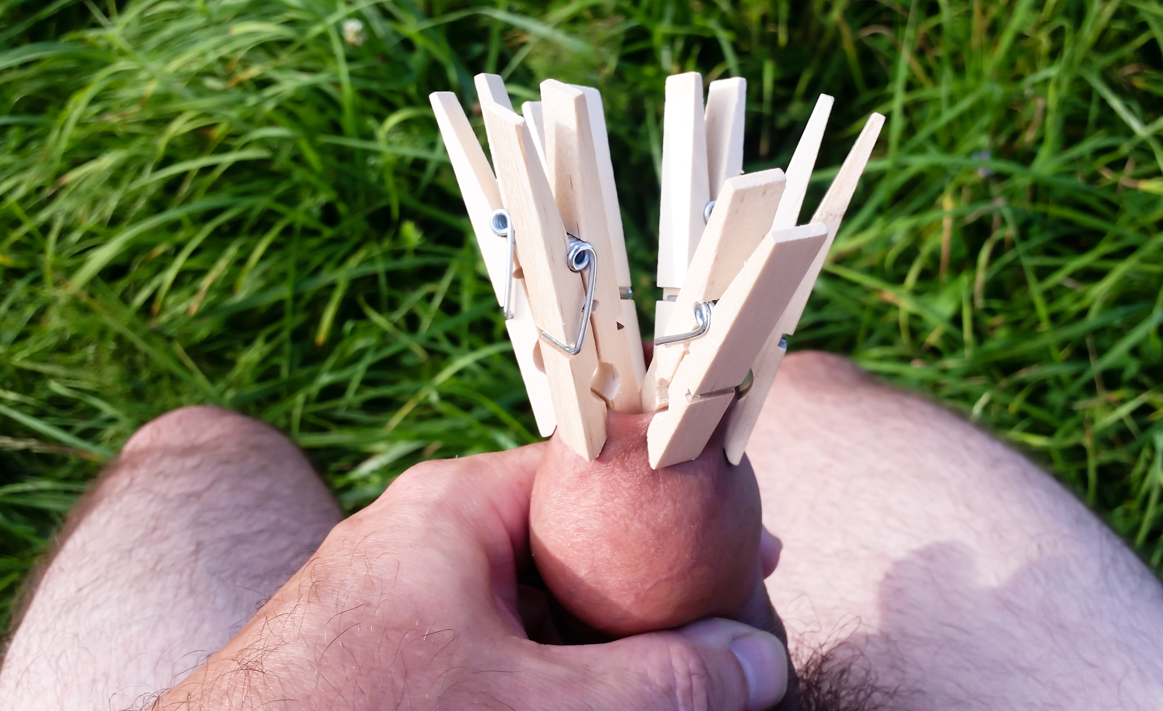 My foreskin with clothes pins