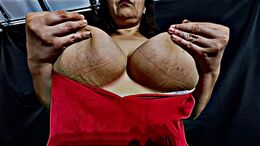 Tits bruised